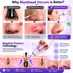 Blackhead Remover Vacuum – 5-Level Pore Cleaner & Facial Acne Extractor with LED Display | USB Rechargeable