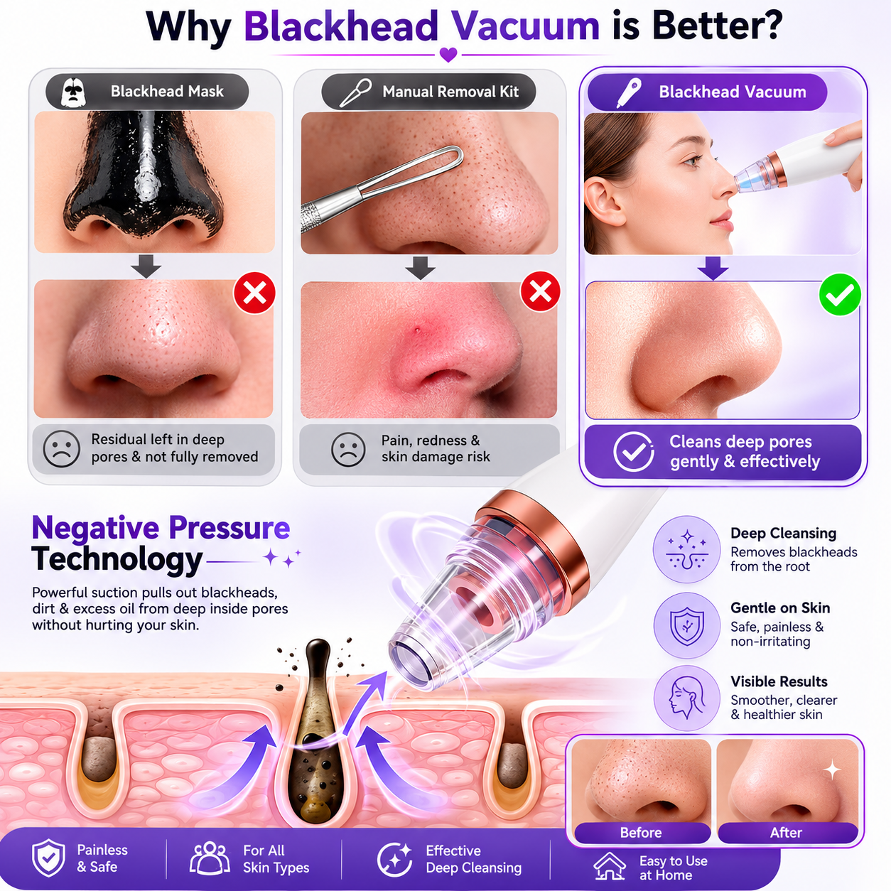 Blackhead Remover Vacuum – 5-Level Pore Cleaner & Facial Acne Extractor with LED Display | USB Rechargeable